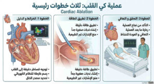 عملية كي القلب